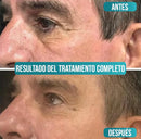 Crema Antiedad para Hombres - VezeMen [Vitamina C, Ácido Hialurónico + Niacinamida]